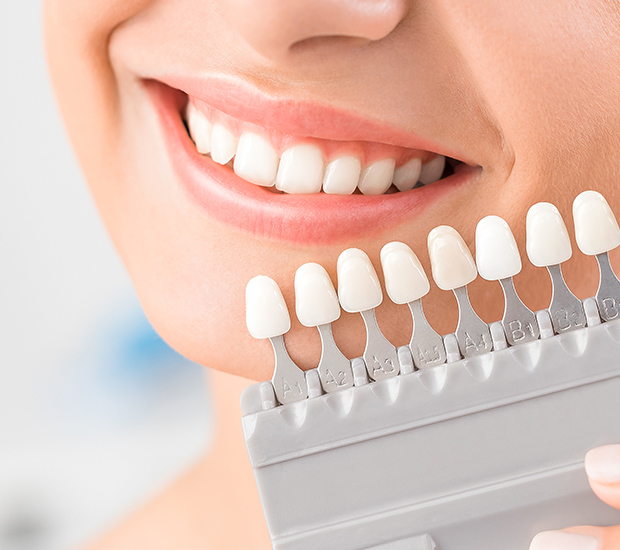 Tustin Dental Veneers and Dental Laminates