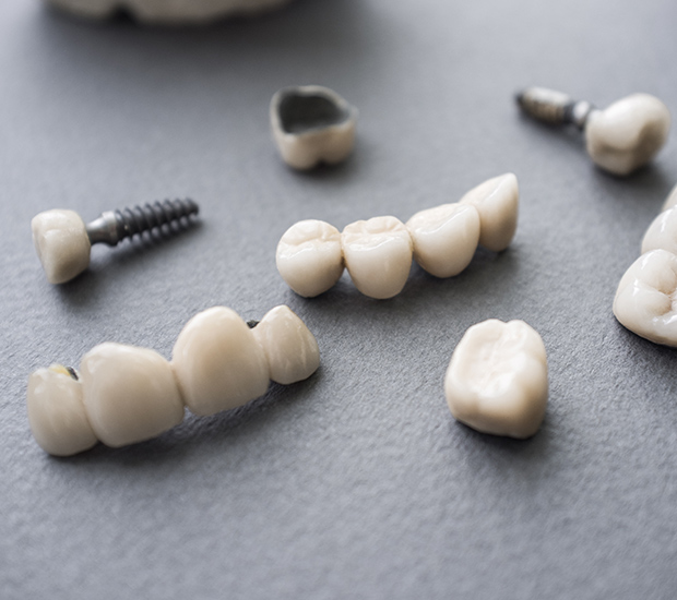 Tustin The Difference Between Dental Implants and Mini Dental Implants
